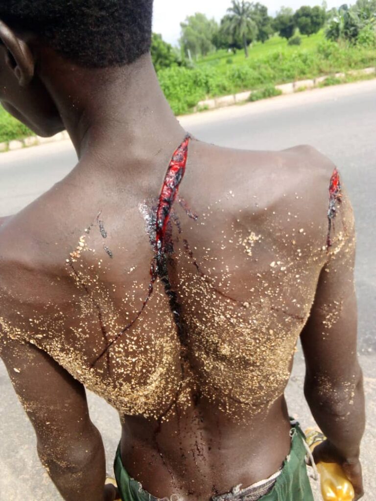 Taraba Gov’s Adviser Accused of Stabbing Mentally Challenged Teenager