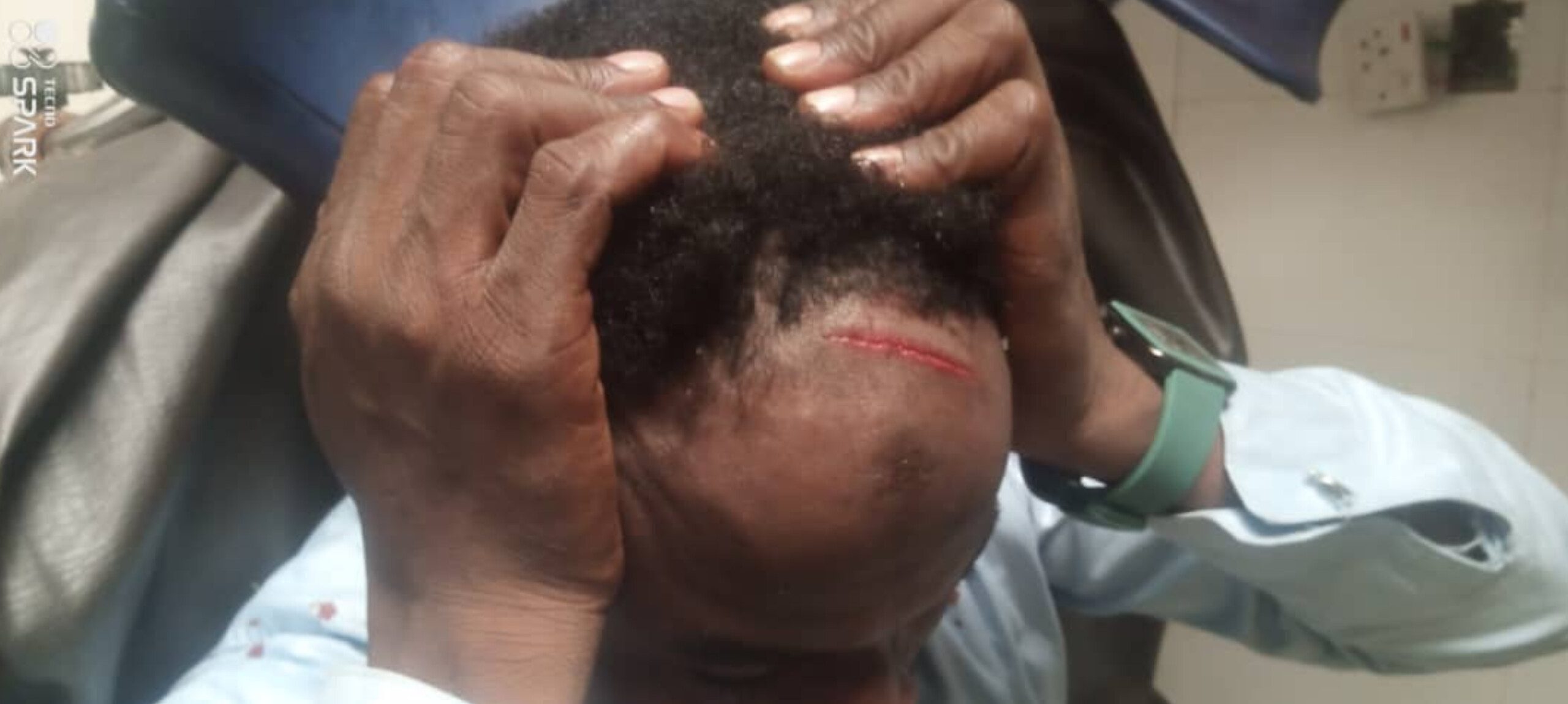 2027 Tensions Boil Over: APC Rally Turns Deadly in Jigawa